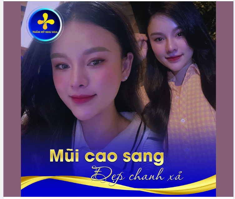 Mũi cao sang – chuẩn tỷ lệ vàng