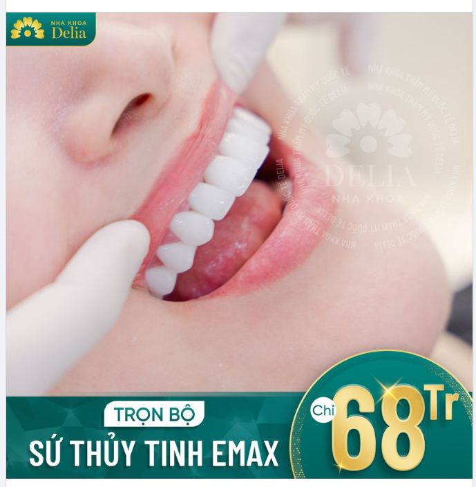 Trọn bộ răng sứ thủy tinh Emax - Bền đẹp dài lâu