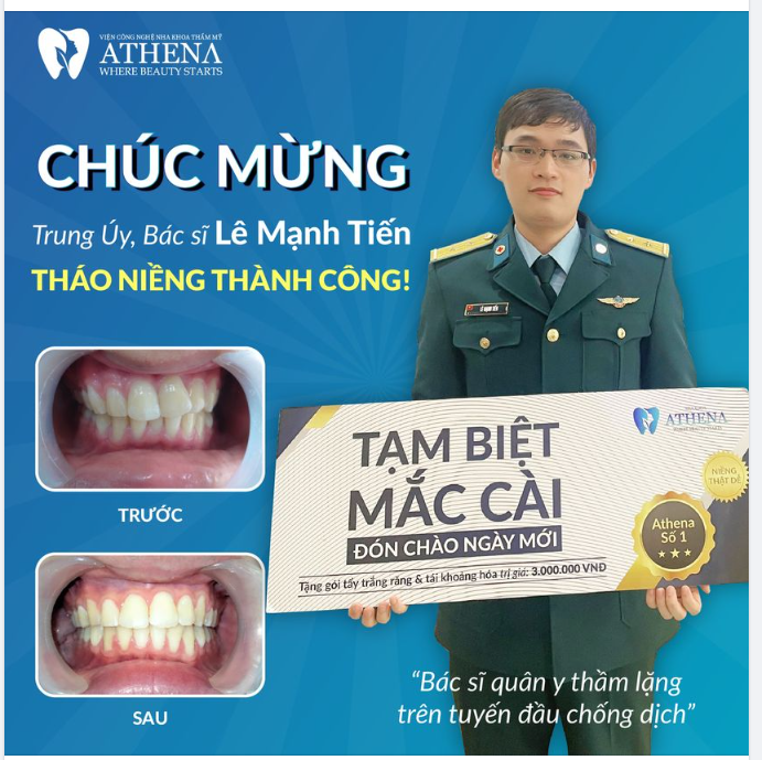 Chúc mừng Trung Uý, Bác sĩ Quân Y Lê Mạnh Tiến tháo niềng thành công!
