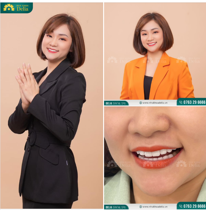 Cùng ngắm nhìn nụ cười rạng rỡ của chị Trang sau thẩm mỹ răng sứ tại nha khoa Delia.