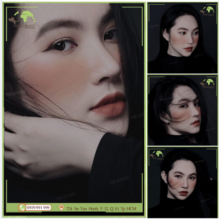 Cô ấy đã thay đổi bằng giải pháp N.âng mũi cấu trúc bằng sụn tự thân để sở hữu riêng cho chính mình phiên bản hoàn hảo ở thời điểm hiện tại!