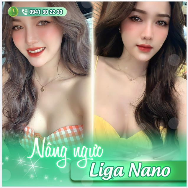 NGỌC ANH QUYẾN RŨ VỚI V1 LIGA NANO