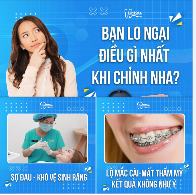 ĐIỀU GÌ KHIẾN BẠN LO NGẠI NHẤT KHI CHỈNH NHA ?