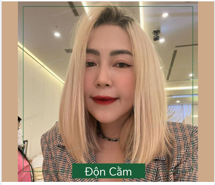 Trông khuôn cằm tròn đầy, không có lõm cằm, không nhọn hoắt như yêu tinh, ai cũng ngỡ là cằm tự nhiên, làm em ngại hết sức