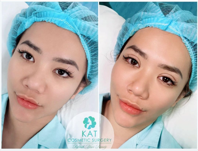 Một trong những vị khách hàng đầu năm mới đã tin tưởng và chọn KAT làm nơi để giúp bạn tạo hình một đôi mắt thật xinh ​​​​​​​.