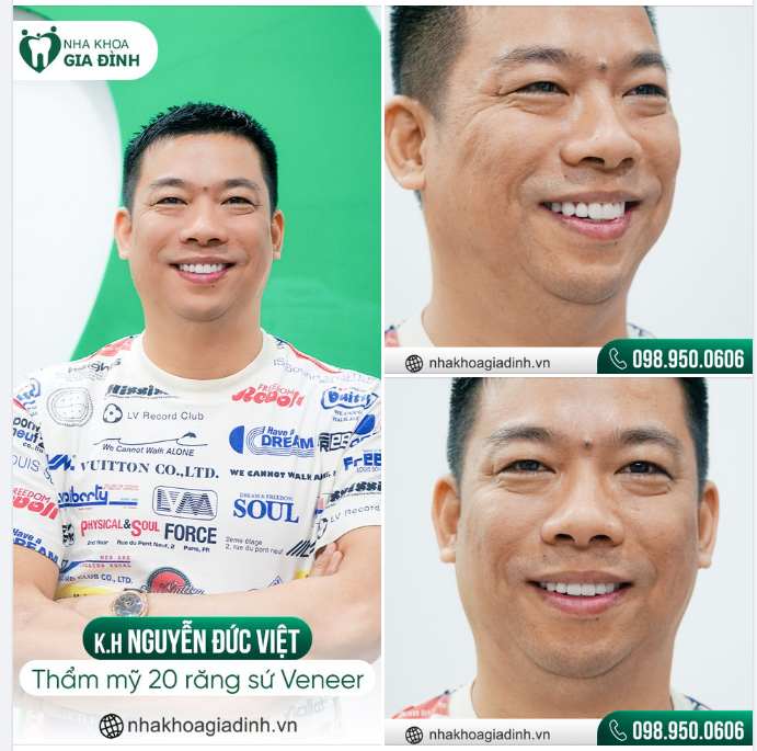 KHI NGƯỜI ĐÀN ÔNG CÓ NỤ CƯỜI TỎA SÁNG SẼ THẾ NÀO?