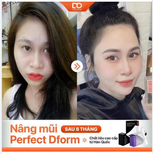 DÁNG MŨI LÀM THAY ĐỔI CẢ DIỆN MẠO
