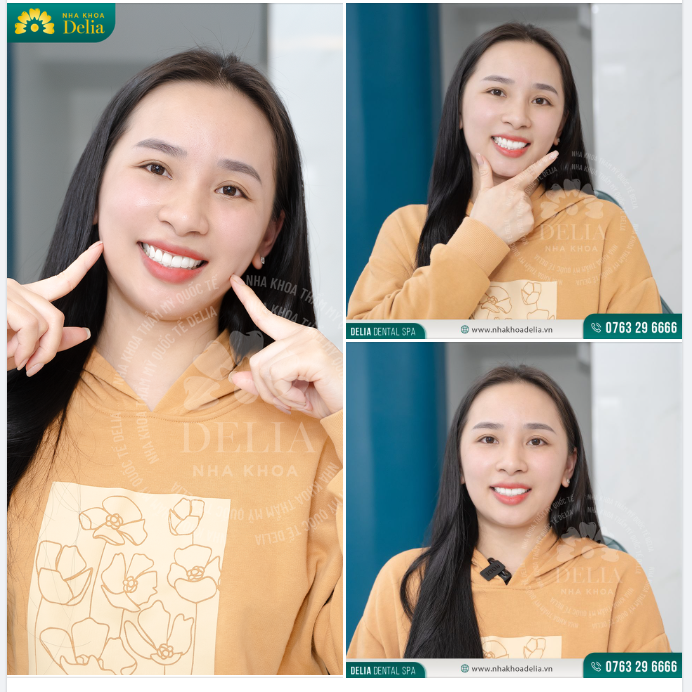 Thêm một nụ cười mới rạng rỡ "Made by Delia"