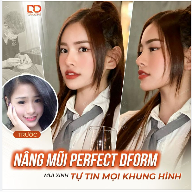 CHIẾC MŨI LÀ TRUNG TÂM CỦA GƯƠNG MẶT