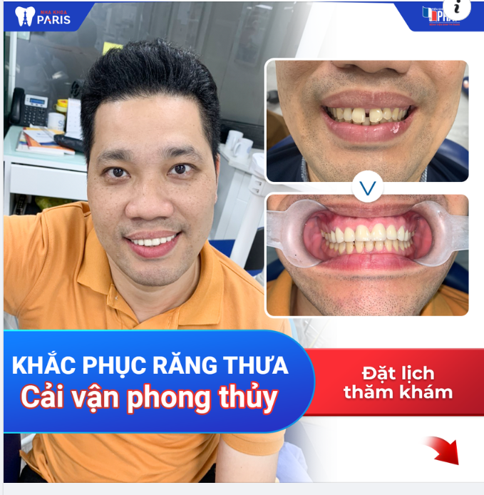 KHE THƯA RĂNG CỬA ẢNH HƯỞNG THẾ NÀO TỚI PHONG THỦY?