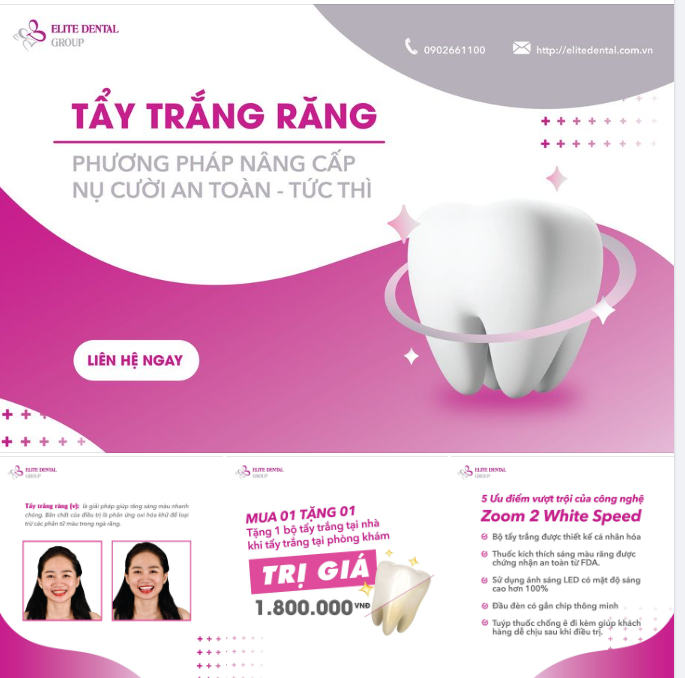 Tẩy trắng răng là phương pháp thẩm mỹ răng an toàn?- Đúng nhận/ sai không thể cãi