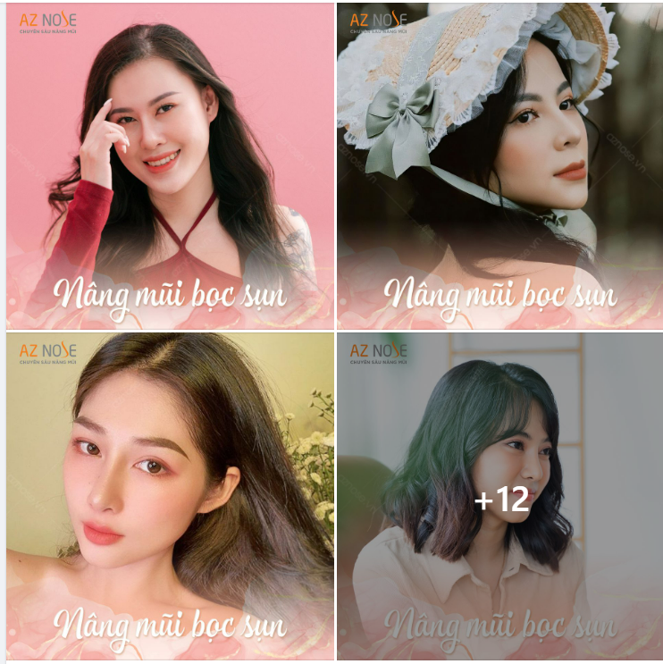 “Tưởng không đẹp mà đẹp không tưởng” với dáng mũi từ phương pháp bọc sụn
