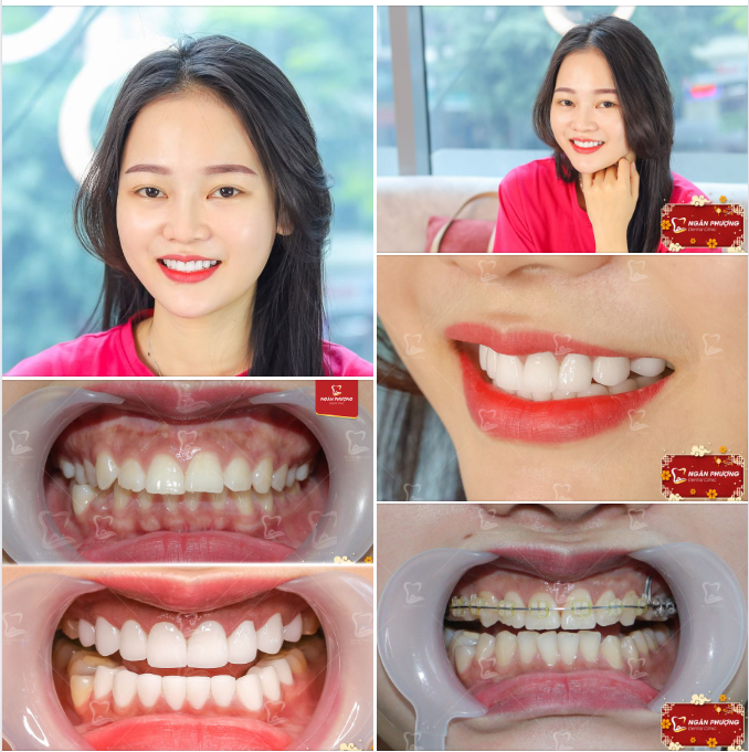 Sen hồng một độ, em hồng một thuở xuân xanh