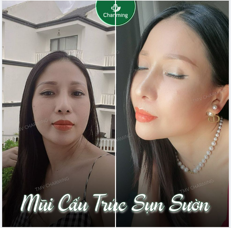Mở cửa ra cho nắng sớm vào phòng, Nắng nhìn nắng thích vì mình nâng mũi xinh