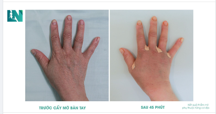 BÍ QUYẾT SỞ HỮU ĐÔI TAY BÚP MĂNG, MỀM MẠI SAU 45 PHÚT