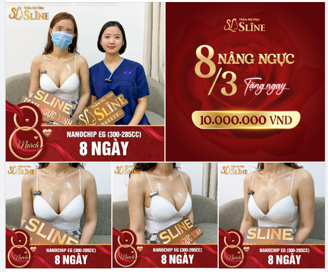 Ở ĐÂY CÓ NGỰC ĐẸP NGAY CHỈ SAU 8 NGÀY