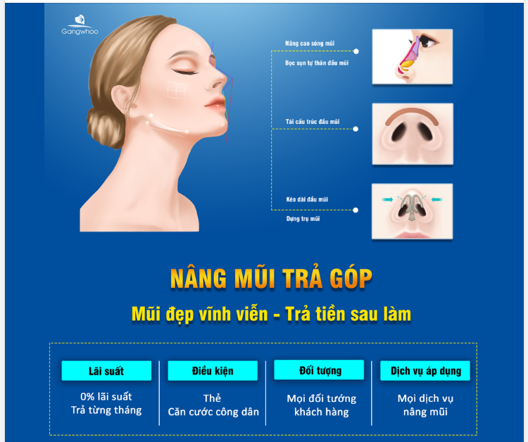 NÂNG MŨI TRẢ GÓP - MŨI ĐẸP VĨNH VIỄN, TRẢ TIỀN SAU LÀM