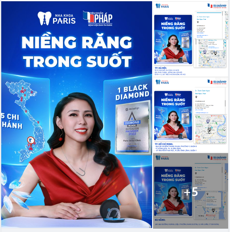 Niềng Răng Trong Suốt Invisalign