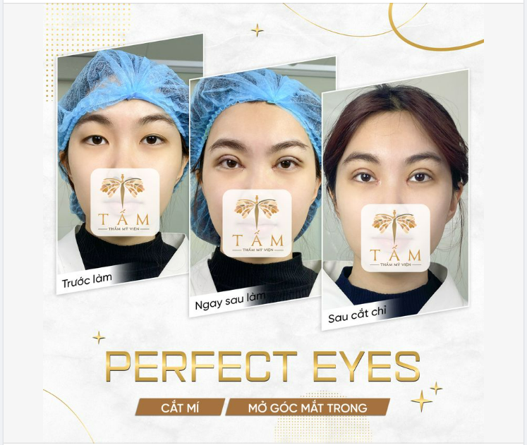 Kết quả thực tế khách hàng tại TMV Tấm!