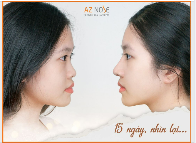 “Dù làm sale nhưng trước đây mình rất ngại khi nói chuyện với khách hàng, cứ sợ người ta “chê” cái mũi...