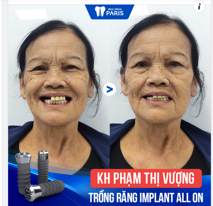 Khách hàng Phạm Thị Vượng - 73 tuổi