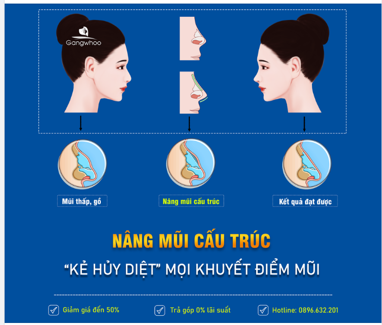 VÌ SAO 80% KHÁCH HÀNG NGÀY NAY ĐỀU CHỌN NÂNG MŨI CẤU TRÚC?