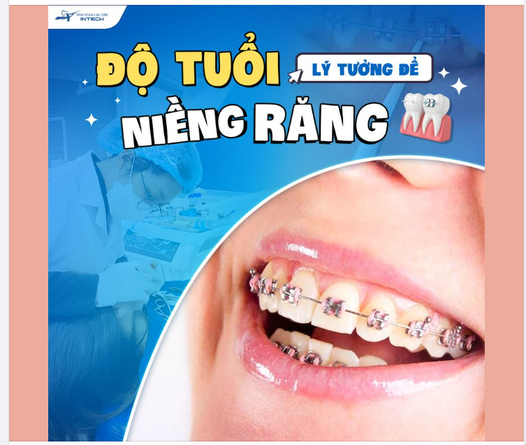 ĐỘ TUỔI LÝ TƯỞNG ĐỂ NIỀNG RĂNG?