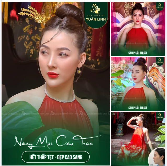 ĐẸP RẠNG RỠ ''NHƯ HOA MÙA XUÂN'' CÙNG CHIẾC MŨI CAO XINH.