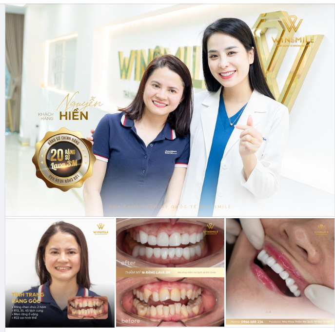 CÁI KẾT NGỌT NGÀO CHO SỰ CAN ĐẢM