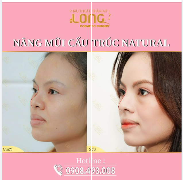 ĐÓN NĂM MỚI BÙNG NỔ ƯU ĐÃI MỚI
