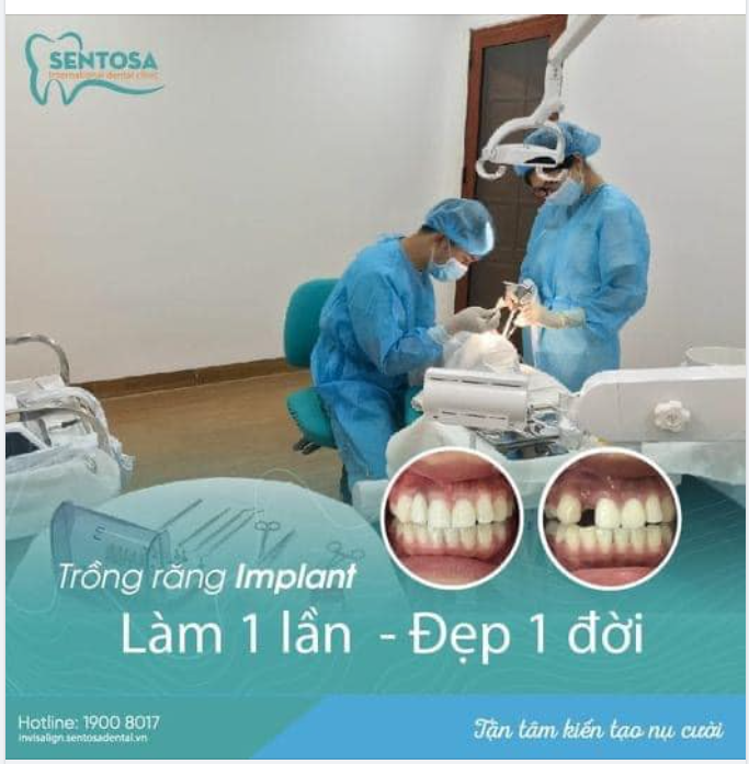 TRỒNG RĂNG IMPLANT- LÀM MỘT LẦN DÙNG MỘT ĐỜI