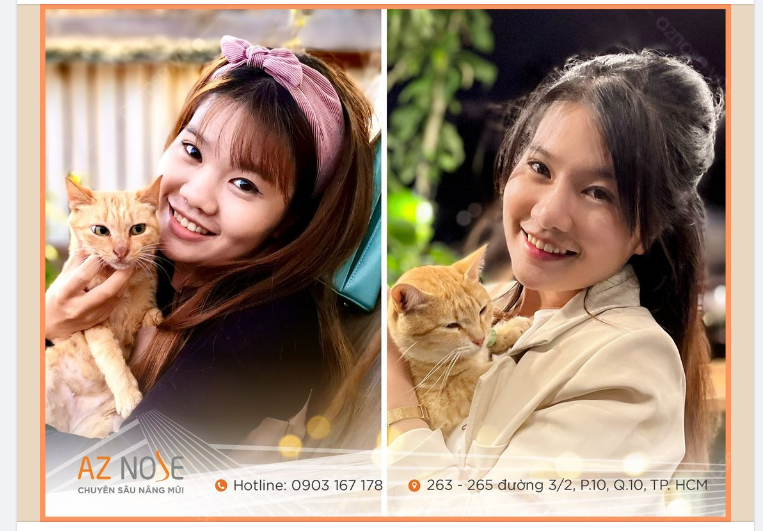 "Mũi nguyên thủy của em tẹ.t và ng.ắn lắm, bác Tùng ráng "kéo" hết sức nhưng vẫn trong mức an toàn để được lâu dài cho em.