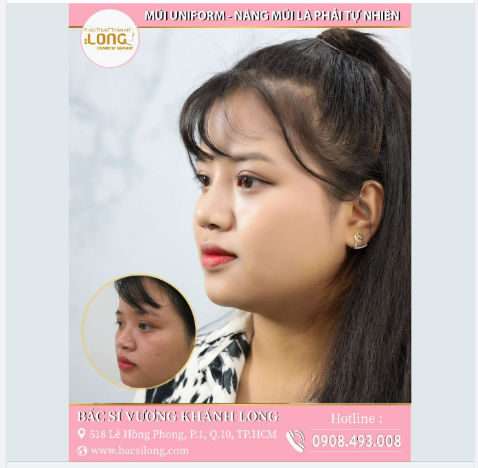 NÂNG MŨI HÚT MỌI VẬN MAY