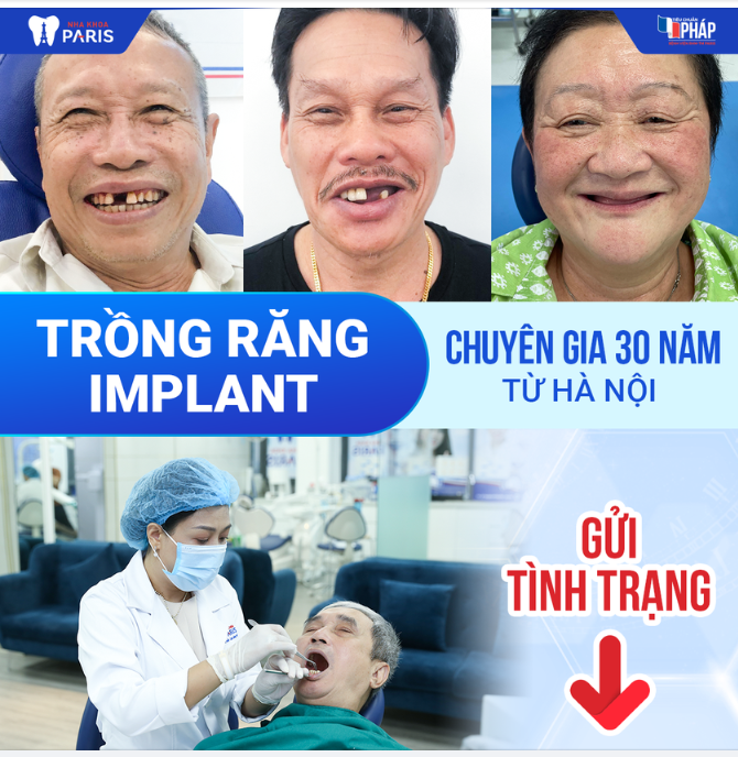TRỒNG RĂNG CÙNG TS.BS TRÂM 30 NĂM