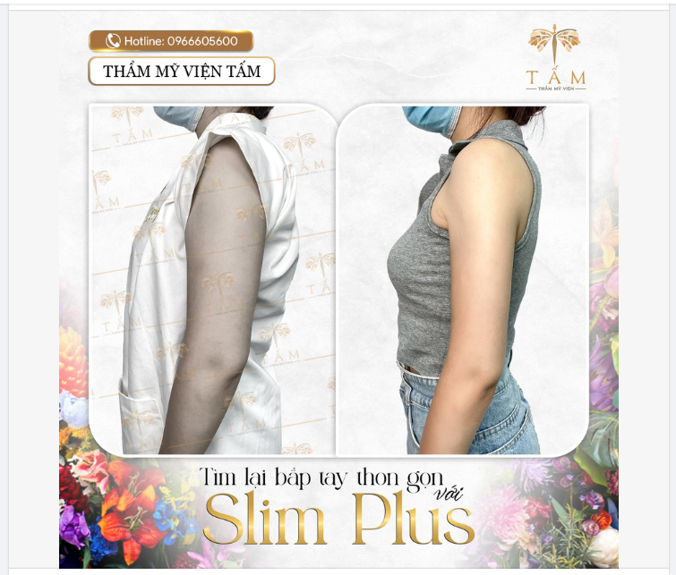 Tìm lại bắp tay thon gọn với Slim Plus