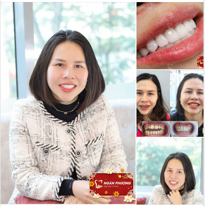 Khi nụ cười đẹp là cả một quá trình kiên trì