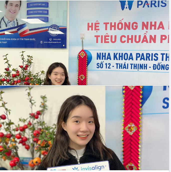Quá trình niềng răng có thể mất một chút thời gian để thích nghi, nhưng nó sẽ mang lại kết quả cuối cùng tuyệt vời.