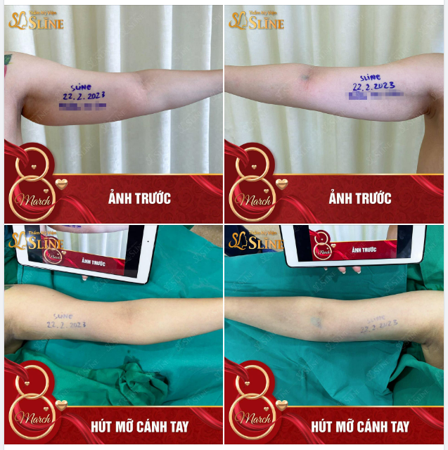 PHẢI CHIA SẺ NGAY LẬP TỨC CASE NÀY THÔIII
