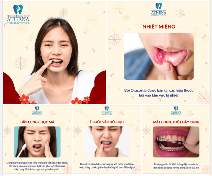 CÁC SỰ CỐ THƯỜNG GẶP KHI NIỀNG RĂNG VÀ CÁCH KHẮC PHỤC ĐƠN GIẢN TẠI NHÀ