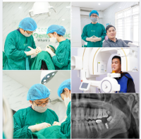 Khách hàng Minh Đức thực hiện cấy ghép Implant R37 với trụ implant Hàn Quốc cùng bác sĩ Nguyễn Đình Giang tại nha khoa Yteeth.