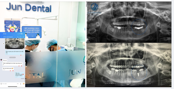 LỜI FEEDBACK YÊU THƯƠNG CỦA KHÁCH HÀNG NHÀ JUN DENTAL