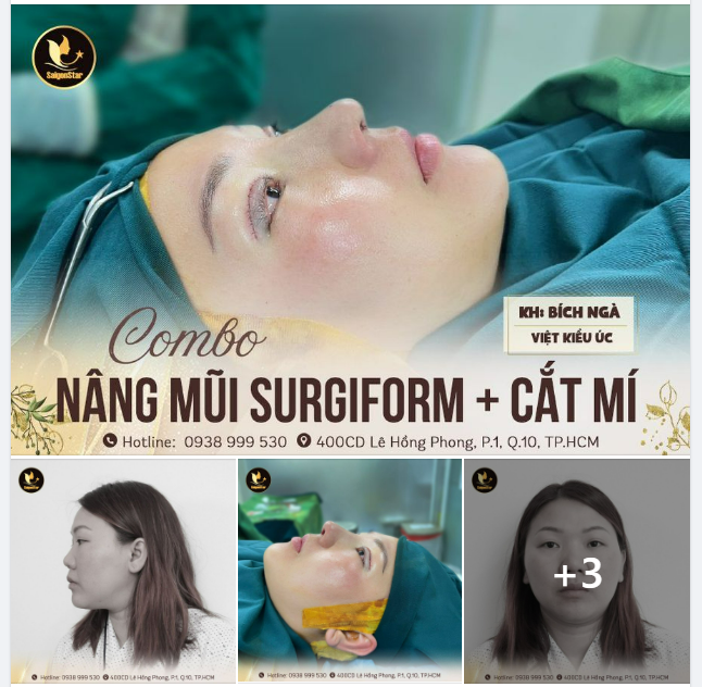 COMBO LỘT XÁC: NÂNG MŨI + CẮT MÍ MẮT