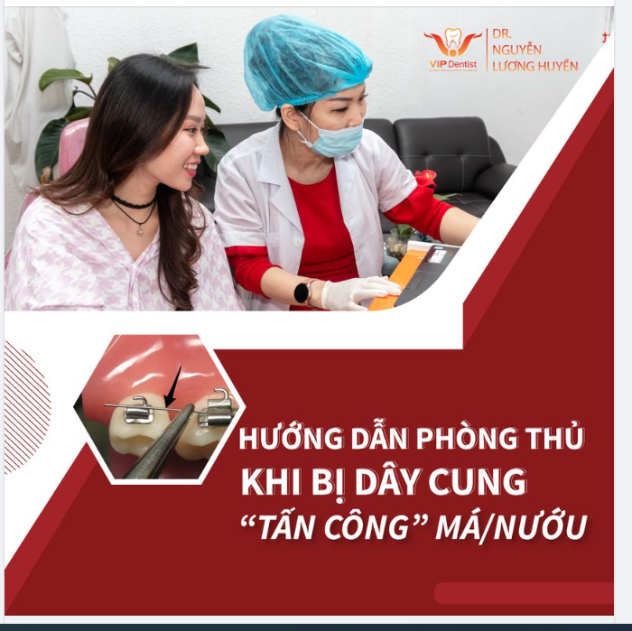 "PHÒNG THỦ" KHI DÂY CUNG BỊ "TẤN CÔNG" MÁ/NƯỚU