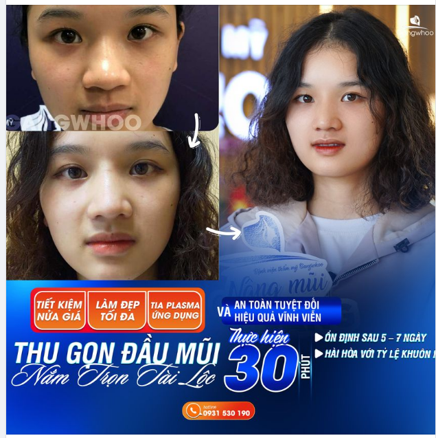 THU GỌN ĐẦU MŨI - BÍ QUYẾT KHẮC PHỤC ĐẦU MŨI TO