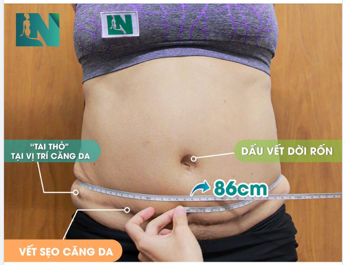 ​​​​​​​Vậy phải giảm mỡ bằng cách nào để có được vòng eo đẹp đúng chuẩn?