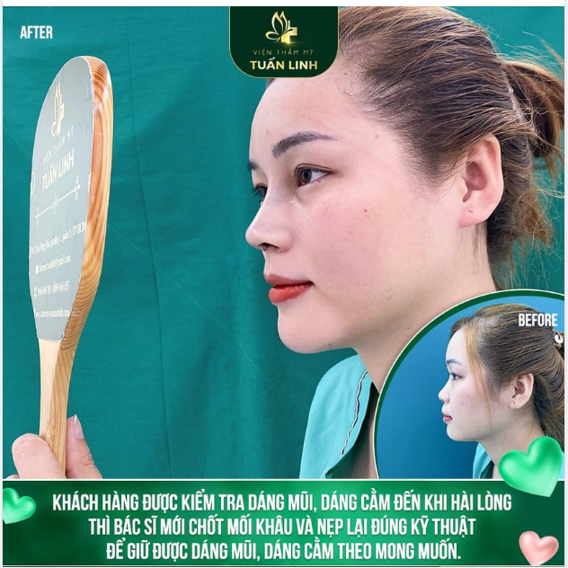 SỰ XINH ĐẸP VÀ HÀI LÒNG CỦA KHÁCH HÀNG LUÔN LÀ YẾU TỐ HÀNG ĐẦU MÀ VTM TUẤN LINH HƯỚNG ĐẾN!