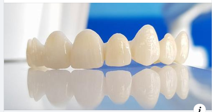 Bọc răng sứ giữ được bao lâu và hướng dẫn chăm sóc sau bọc răng
