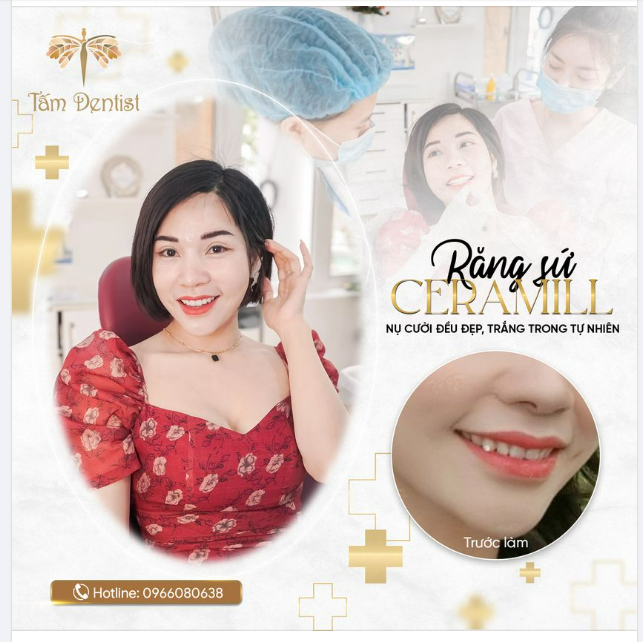 20 răng sứ Ceramill - Nụ cười đều đẹp, trắng trong rất tự nhiên