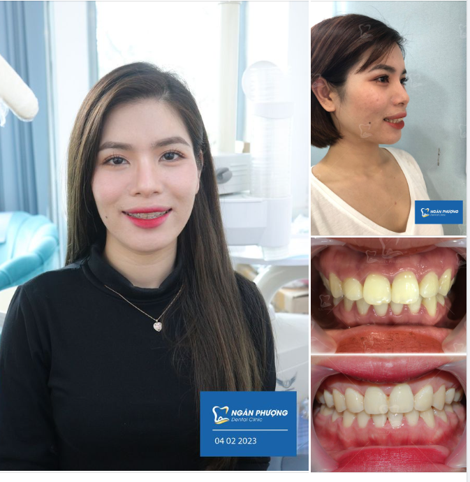 Đã đến lúc phải nói tạm biệt…