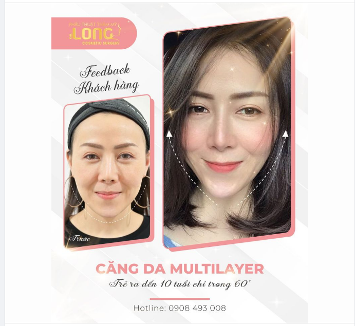 DƯỠNG DA MỖI NGÀY NHƯNG VẪN NHĂN NHEO, THIẾU SỨC SỐNG